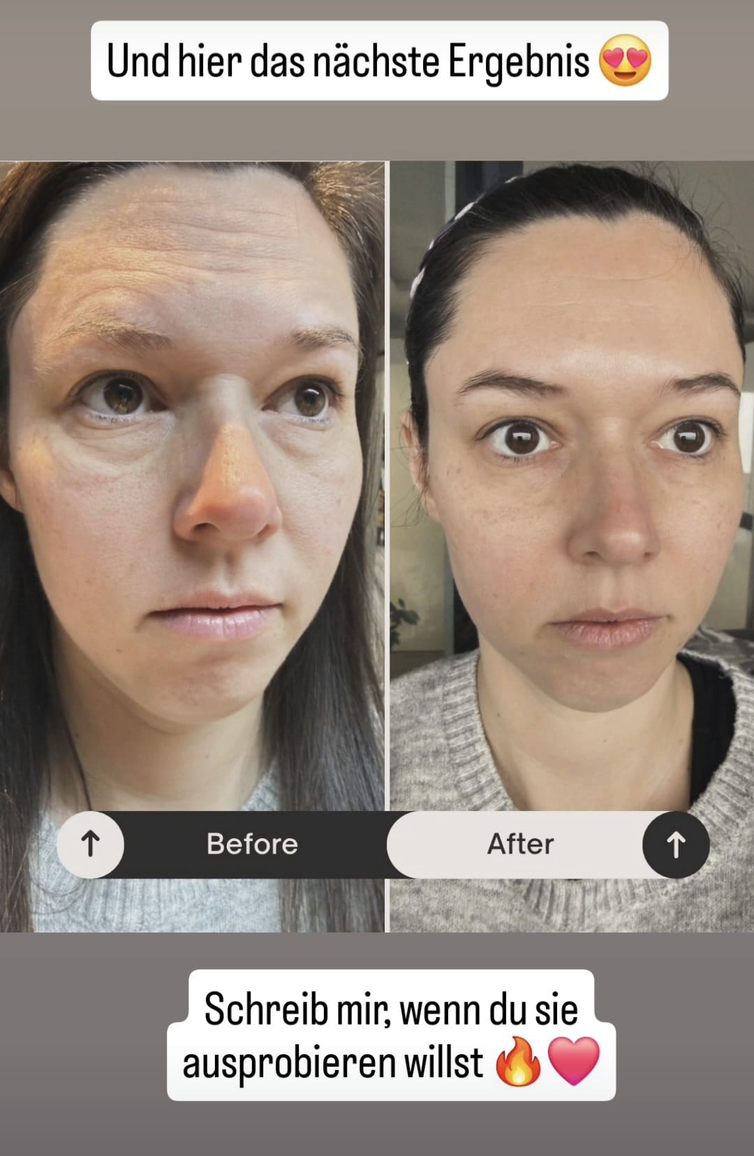 Halbea LightSkin Treatment Gesichtsmaske + Pad mit Hyaluron mit Soforteffekt