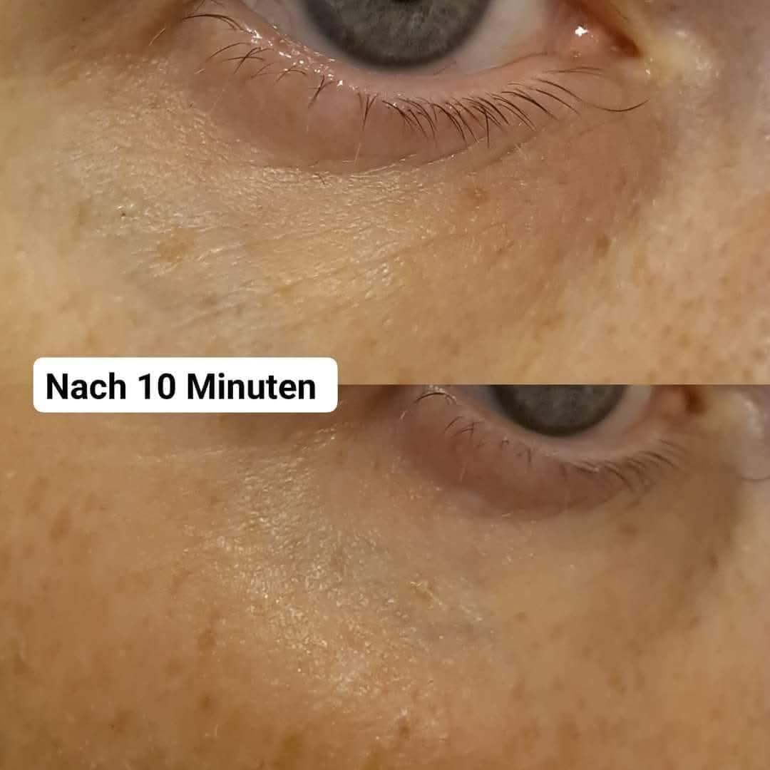 HYLIFT+ Augenserum Soforteffekt Hyaluron Booster